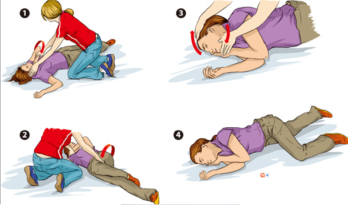 Recovery position before CPR